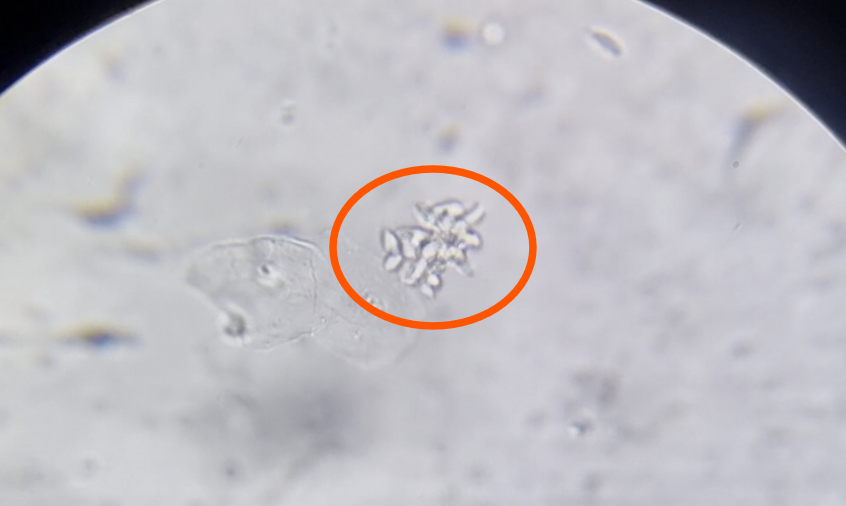 Rzęsistkowica u gołębi